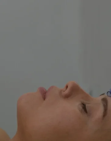 Microneedling RF slider